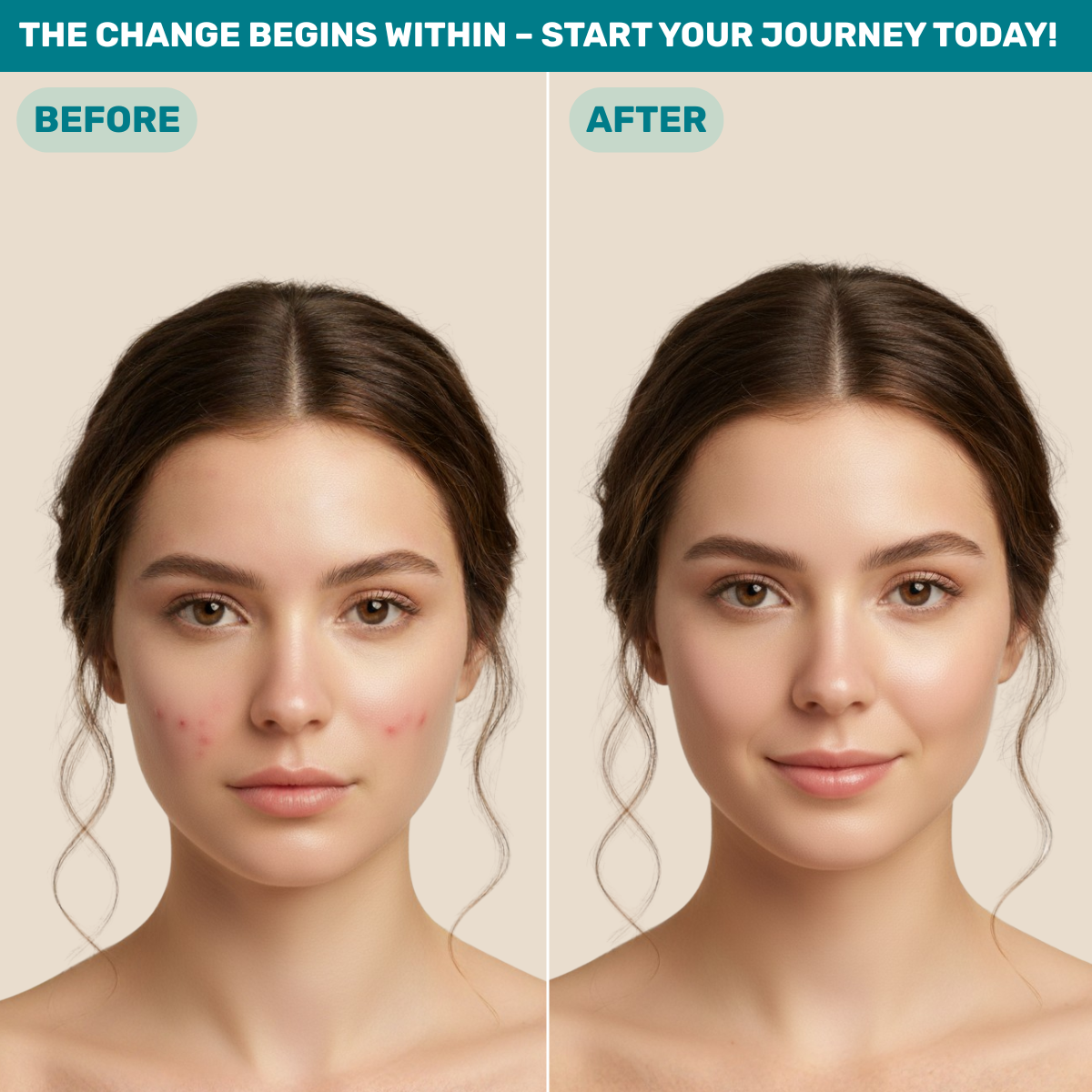 beMe DermaBalance – Food Supplement with Probiotics for Clear and Healthy Skin